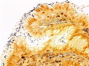 4276A | Control Slides:Histopathology; Helicobacter sp.